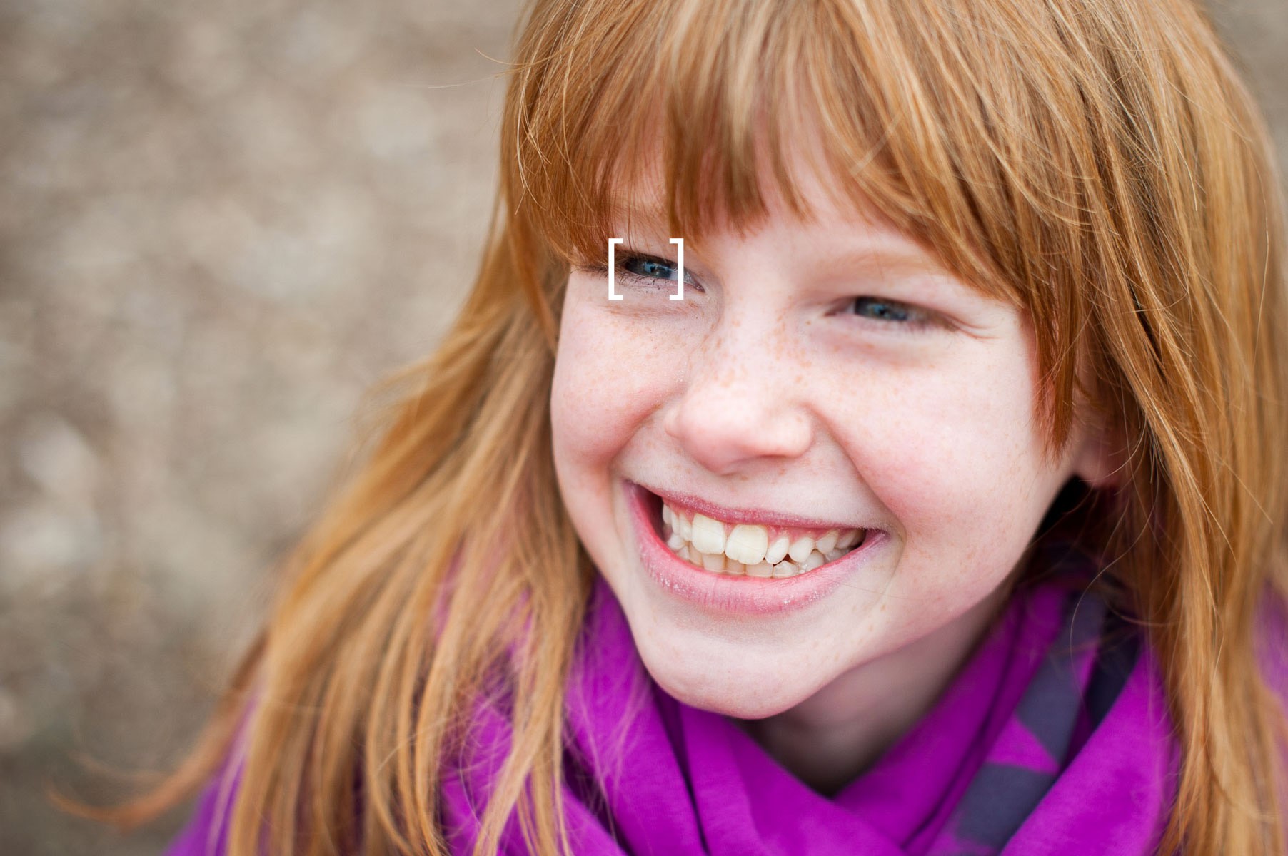 Als het voorste oog onscherp is, dan is dit meestal storend. Als het achterste oog iets onscherp is, dan vinden we dit vaak minder erg.